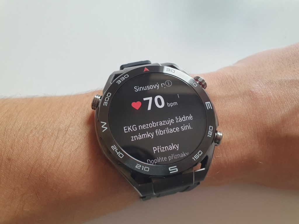 EKG má odhalit fibrilace síní
