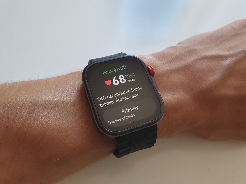 Snímání EKG