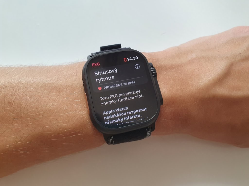 Záznam EKG. (Foto: Martin Dajča)