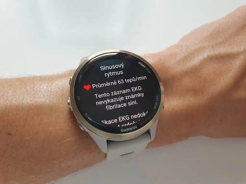 K nejpřesnějším hodinkám v měření tepu patří modely Garminu. (Foto: Martin Dajča)